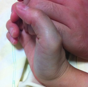 いてててててててててて…(つд⊂)